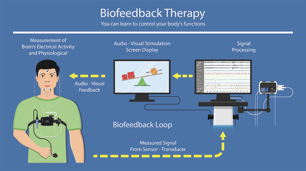 Cefalea a Ardea - bio-theory