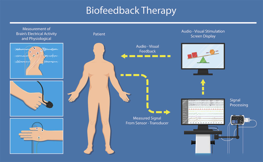 Cefalea a Ardea - bio-therapy-2